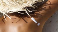През лятото трябва особено бдително да пазим кожата от слънчево изгаряне